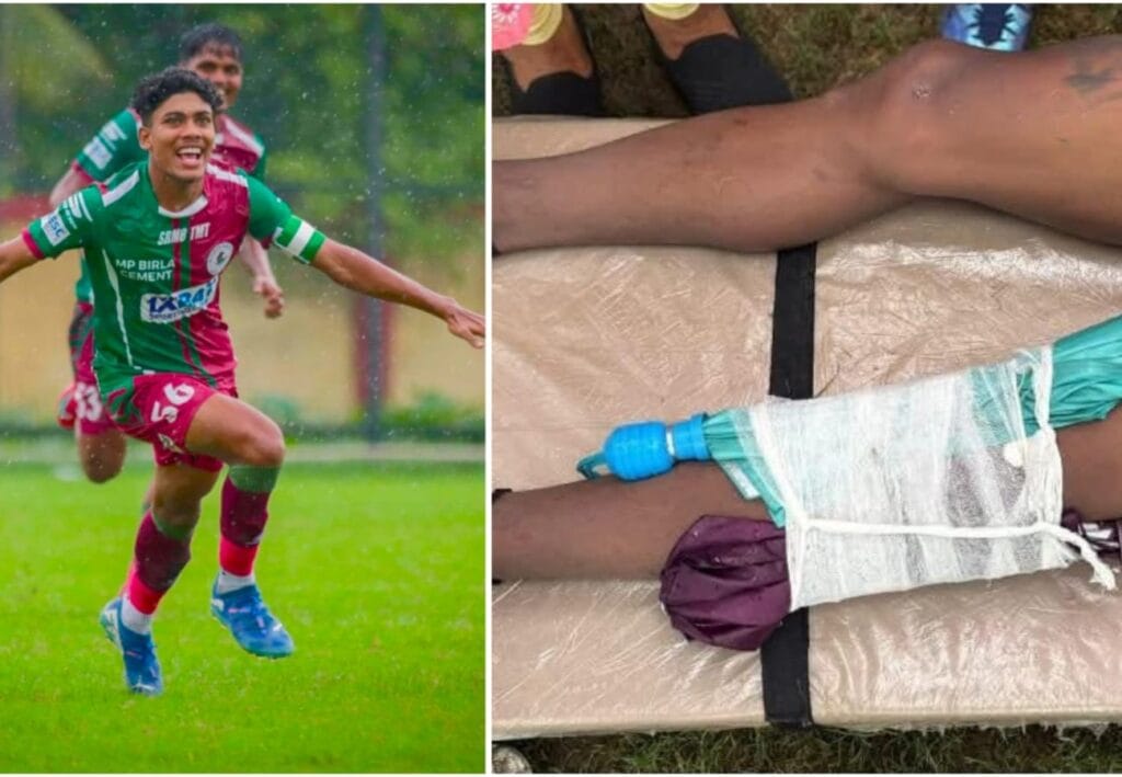 পায়ে ছাতা বেঁধে চিকিৎসা! বেহাল দশা কলকাতা লিগের, জিতল বাগান